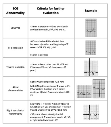 Ecg Interpretation Chart