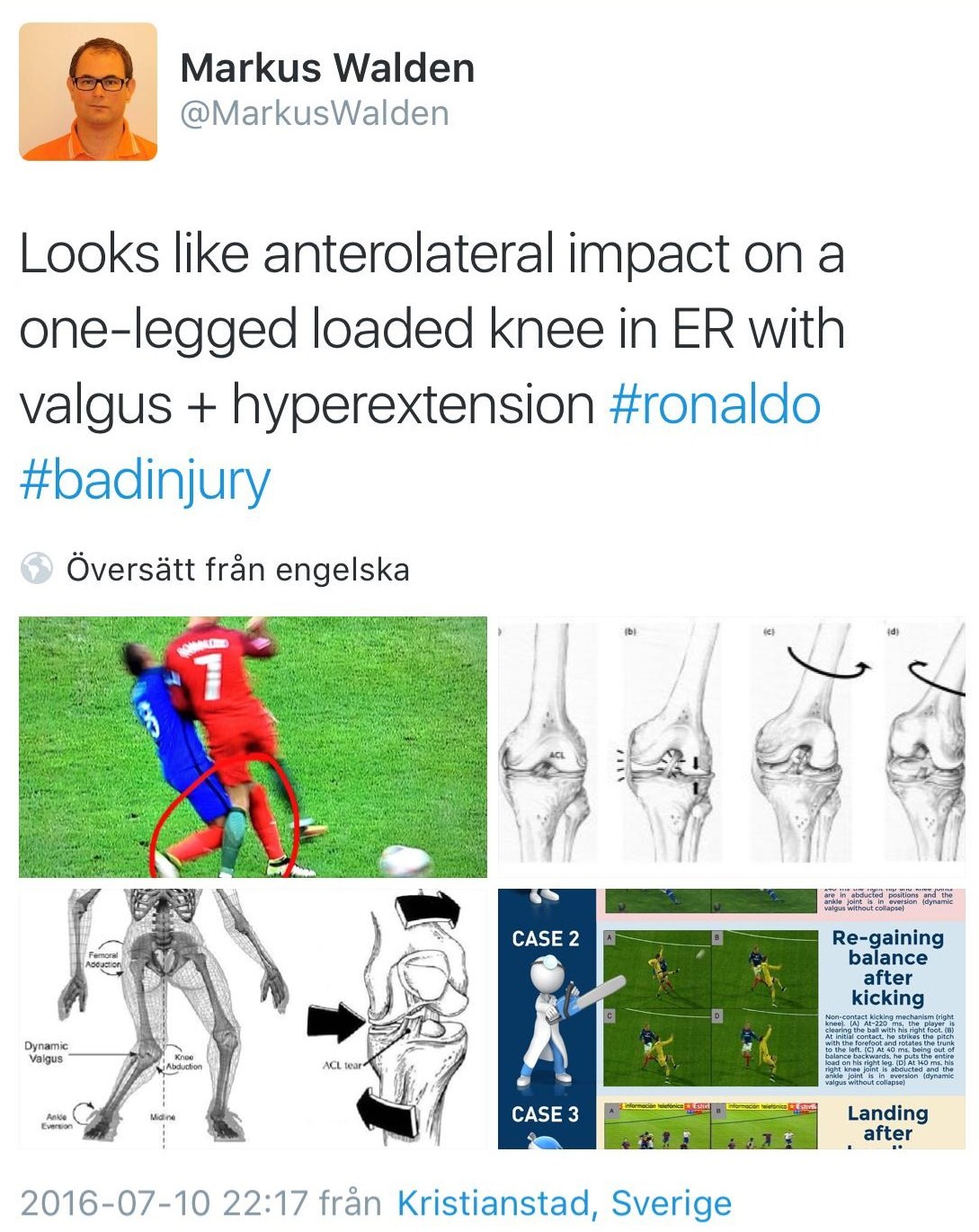 Surprisingly great interest for an MCL sprain - Cristiano Ronaldo and the  2016 UEFA Euro Final - BJSM blog - social media's leading SEM voice