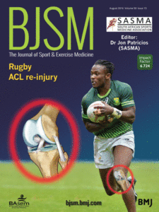 August-50-15: Rugby ACL re-injury