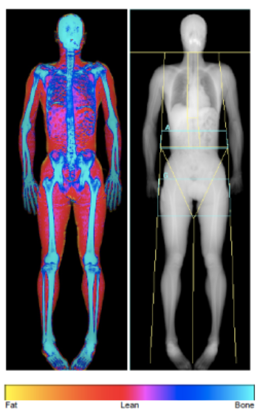 Body composition for health and sports performance - BJSM blog