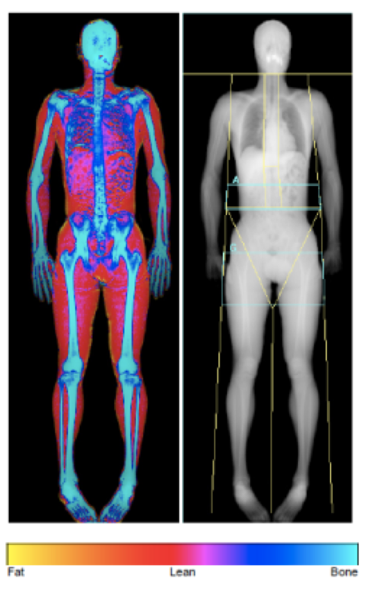 What is Body Composition?