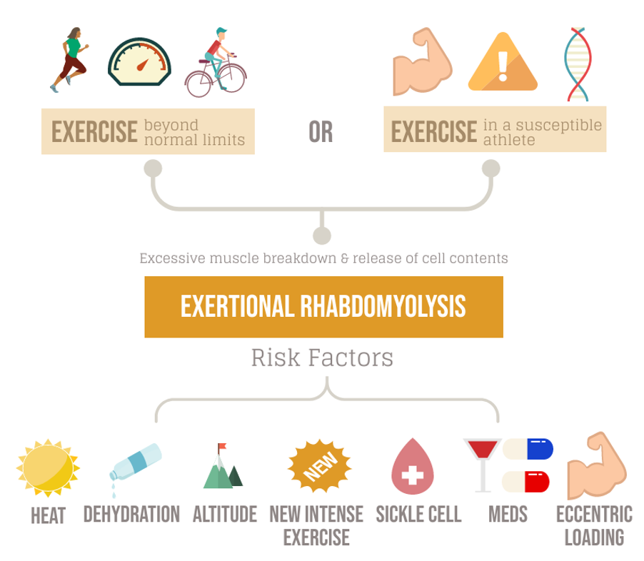 Spin class can lead to rhabdomyolysis in some people