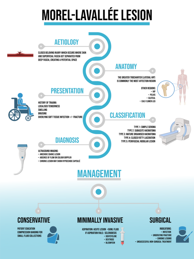 MorelLavallee Lesions Diagnosis and practical management of these