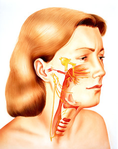 Artwork illustrating trigeminal neralgia