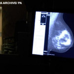 mammogram_room