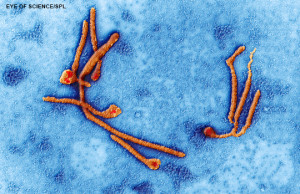 Ebola virus particles, TEM