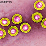 Herpes_Simplex_Virus