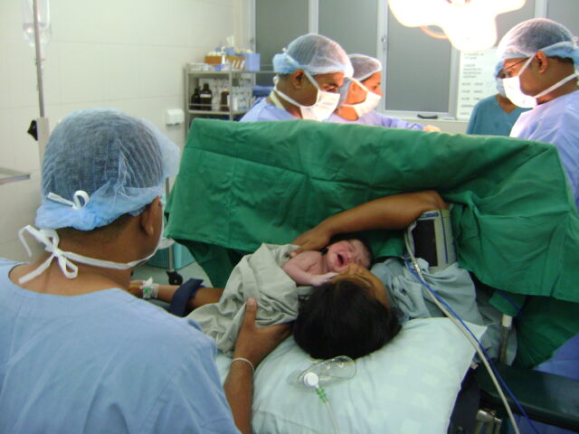 Caesarian Section