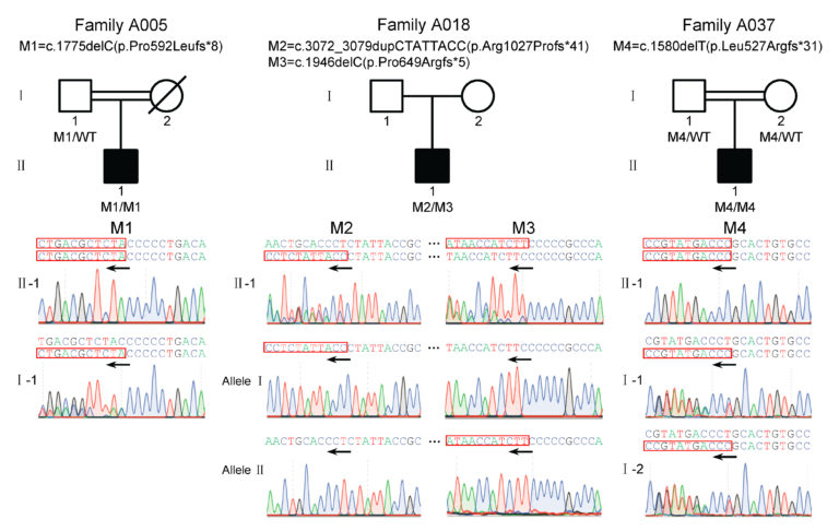 Biallelic Mutations in CFAP65 Cause Male Infertility with Multiple ...