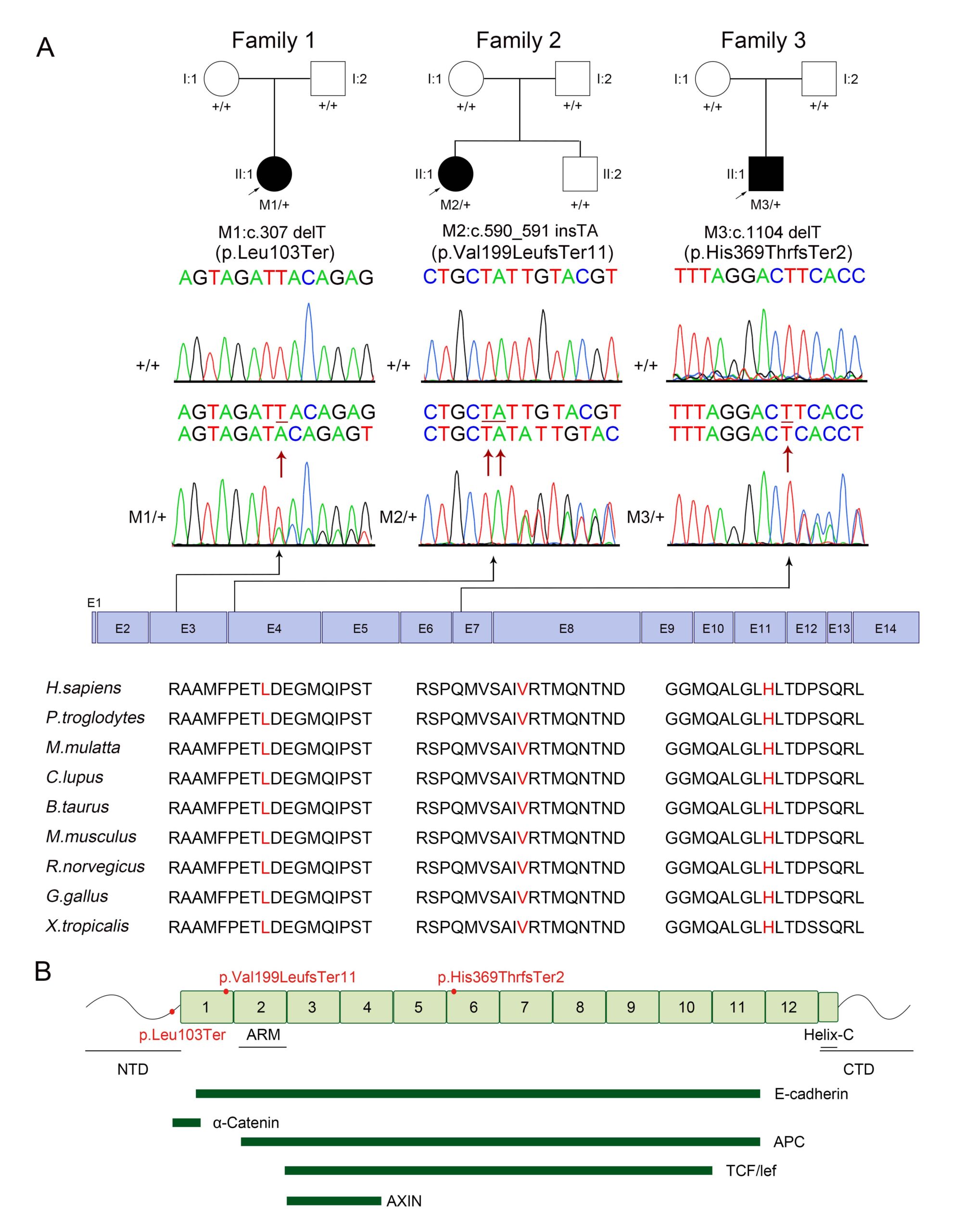 Heterozygous frameshift CTNNB1 variants identified in familial
