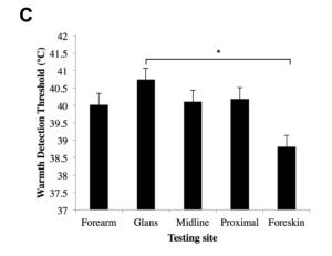 Figure C