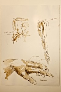 Figure.1_Hand.Shoulder_BMJ