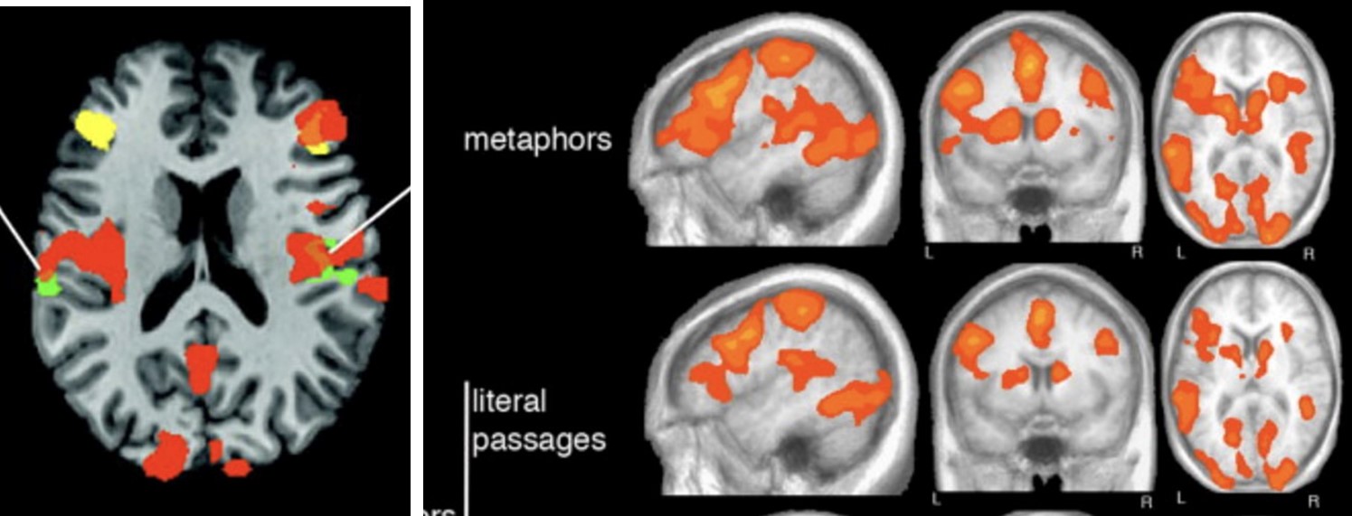 Figure 1. Brain area responses for both metaphorical and literal passages (Bambini et. al).